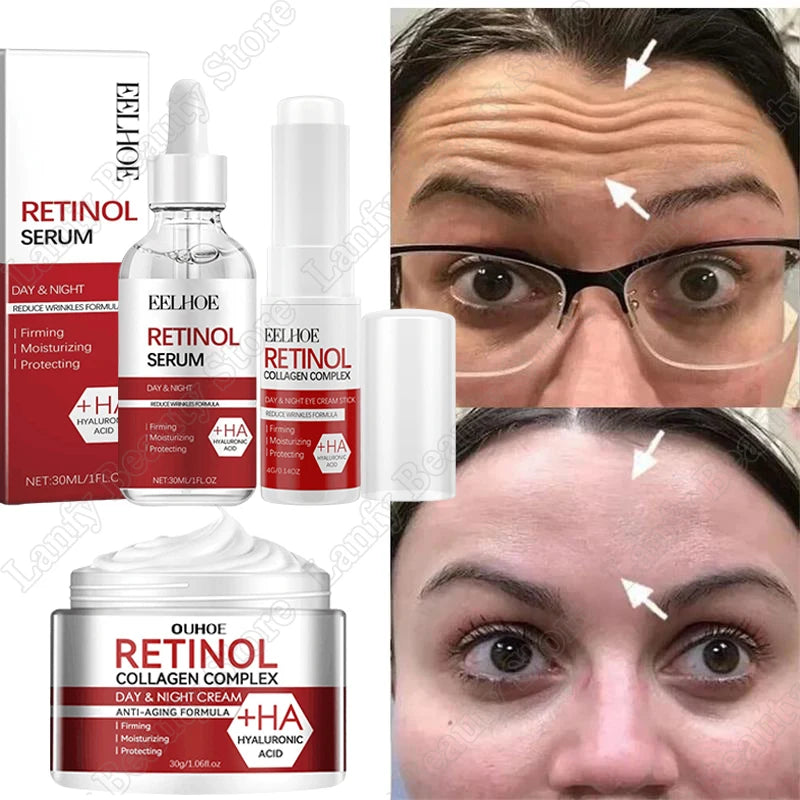 Retinol Wrinkle Remover Face Set